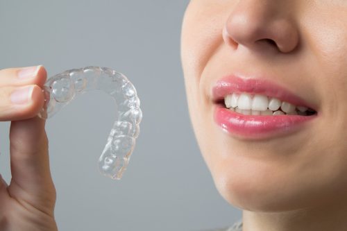 La technologie Invisalign est-elle pour tout le monde ?